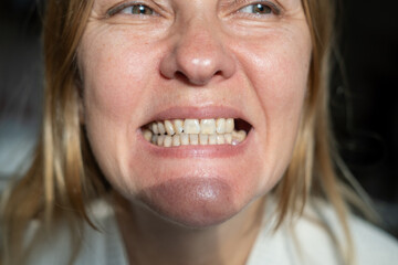 Mature woman is showing mouth without broken tooth. Close-up photo. Gap toothed.