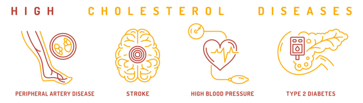 High cholesterol diseases infographic with linear pictograms.