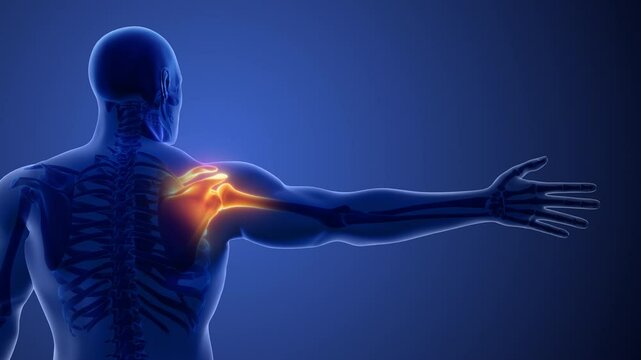 Medical Concept of Shoulder Bone Pain Disorders