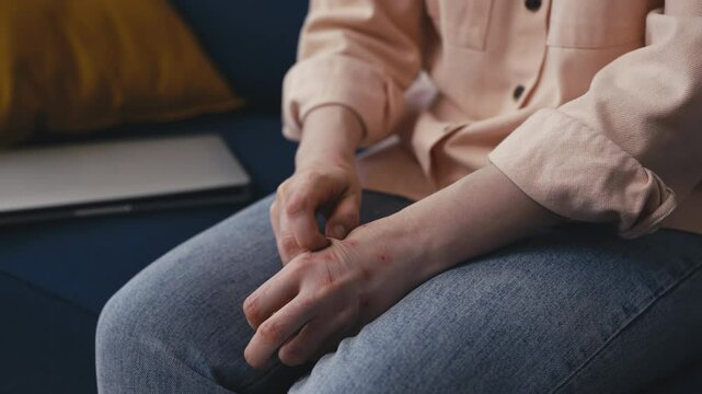 Worried female scratching wounded hand skin, psychological cause for eczema