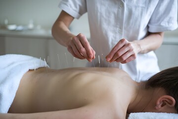 Fototapeta premium Acupuncture Treatment in Progress for Holistic Healing and Wellness