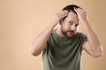 Man with hair loss problem on beige background, space for text