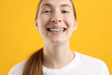 Smiling girl with braces on orange background