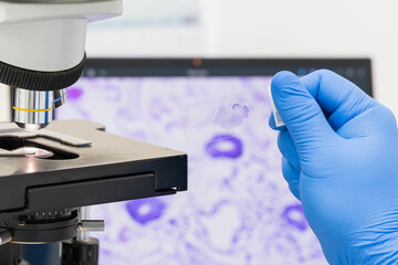 Scientist wear blue glove holding parafin human tissue block and out of focus microscope and...