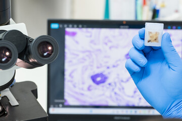 Scientist wear blue glove holding parafin human tissue block and out of focus microscope and...