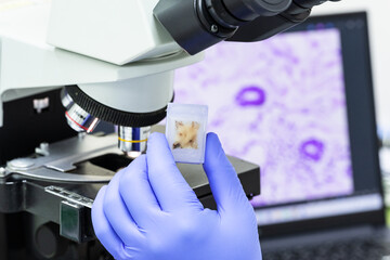 Scientist wear violate glove holding parafin human tissue block and out of focus microscope and...