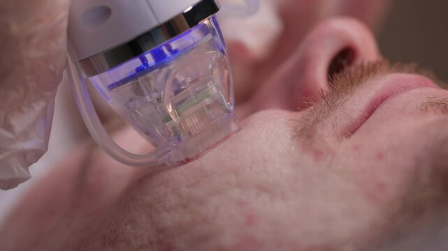 A man is currently undergoing a specialized facial treatment within a serene spa setting