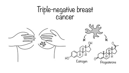 Triple-negative breast cancer