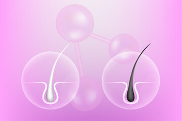 Hyaluronic acid and Niacinamide before and after gray hair and skin solutions ad, pink collagen serum drops into skin cell with cosmetic advertising background ready to use, illustration vector.