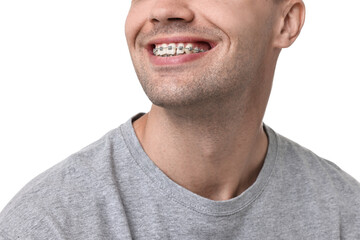 Smiling man with dental braces on white background, closeup