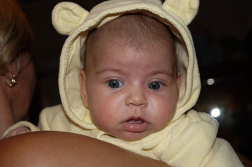 A newborn or infant or toddler or small child with a rash or redness or dermatitis on the face in a hood with ears on the head, in the arms of a woman, with his mouth open, looking down in surprise