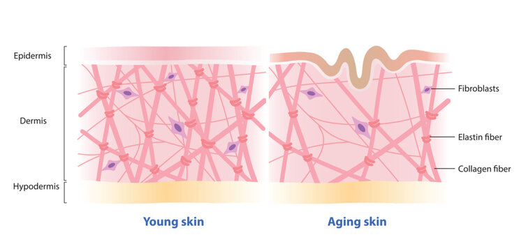 Comparison of young and aging skin vector on white background. Cross section of high and low density of collagen, elastin fibers and fibroblasts in the dermis layer. Skin care and beauty concept.