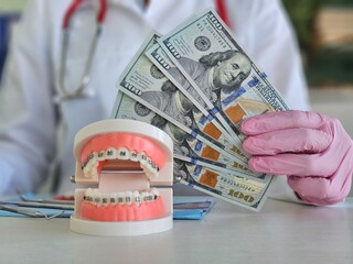 Dental consultation showcasing orthodontic model with braces and a hand holding cash