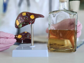 Alcoholic liver damage and liver cirrhosis concept with liver and alcohol