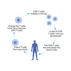 CAR T-cell Therapy Scientific Design. Vector Illustration.
