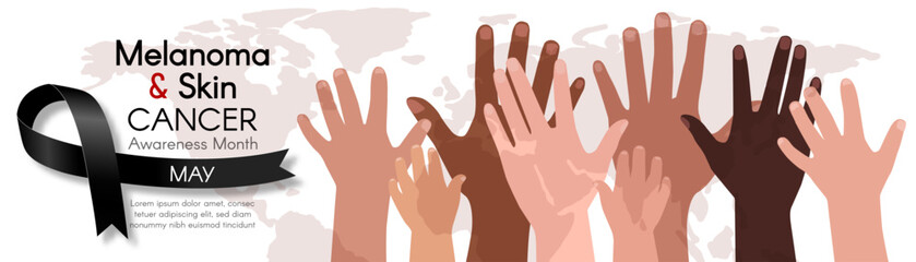 Melanoma and Skin Cancer Awareness Month. Long horizontal banner with Diverse hands, black ribbon, map, and space for text. Vector flat illustration