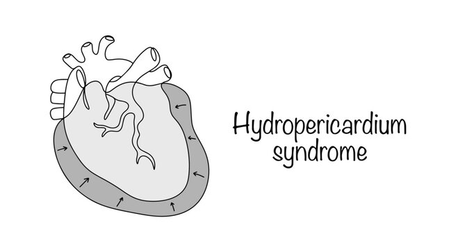 Hydropericardium syndrome
