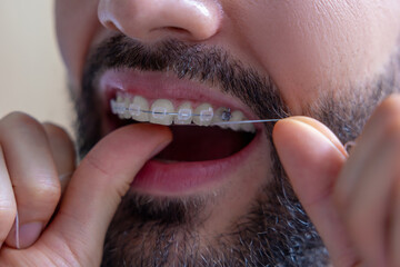 Man with dental floss cleaning teeth and braces