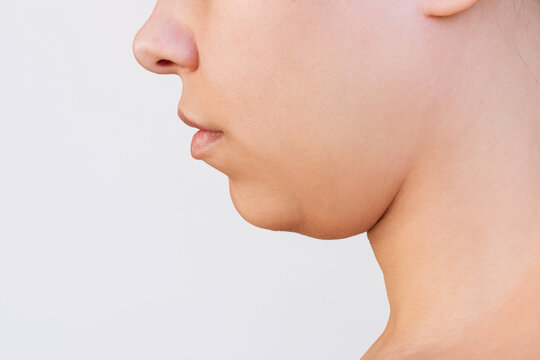 Profile of a young caucasian woman with double chin isolated on a white background. Overweight, flabby and sagging skin. Excess fat on the chin
