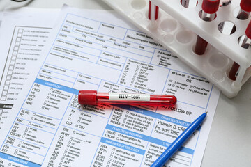 HIV blood test tubes and laboratory report form  on grey background