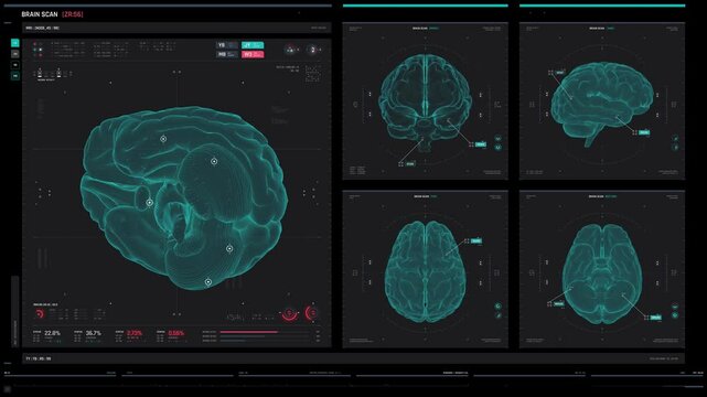 Medical screen overlay in 4k