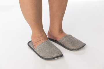 Overweight Senior Women and Ankle Swelling.