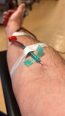 pressure measurement