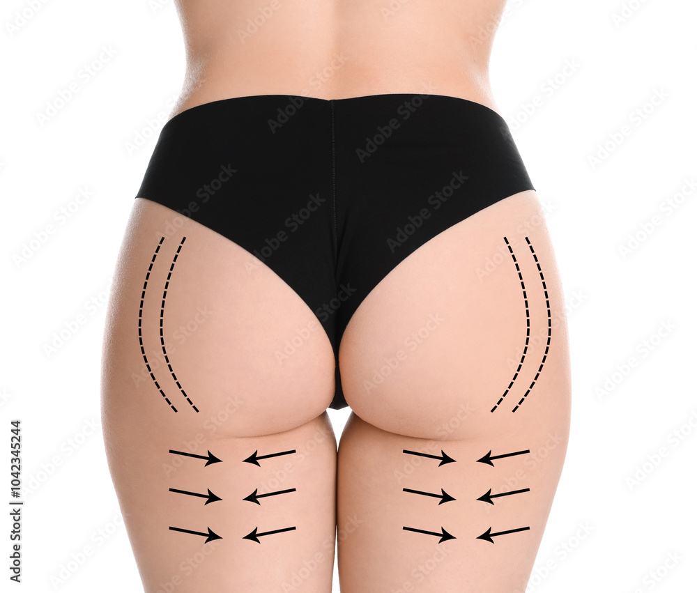 Sticker Woman with perfect slim body on white background, closeup. Figure correction arrows and lines on skin