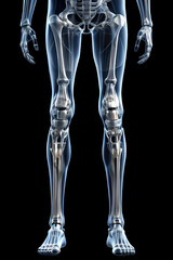 hyper realistic and very detailed x-ray photo of a humanoid metallic and computerised legs
