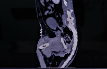 Oncologist, Pet veterinarian examines an MRI of a cat for a tumor and finds one. Note: This cat has...