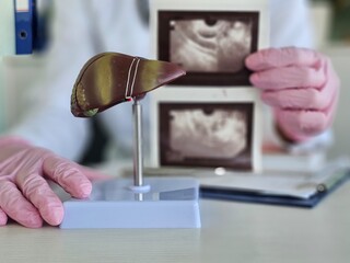 A doctor studies a liver model along with ultrasound images. Ultrasound diagnostics of liver...