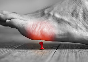 Pin poking into the bottom of a person's foot with red pain area