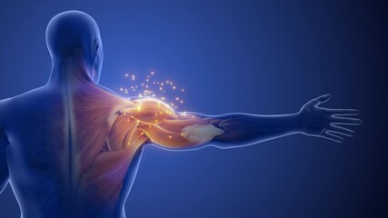 Tingling or Sharp Pain in Shoulder Area