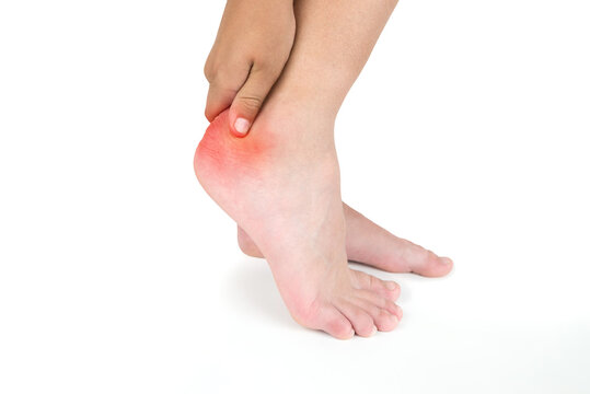 woman having pain in leg holding leg, heel pain, injury, health and medical concept, legs on white.