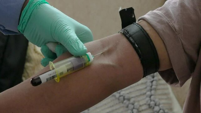 Taking blood sample from right arm of patient to test for various ailments and diseases at 30 fps