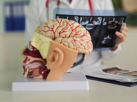 Diagnosis of brain pathology. Doctor holds a model of a human brain