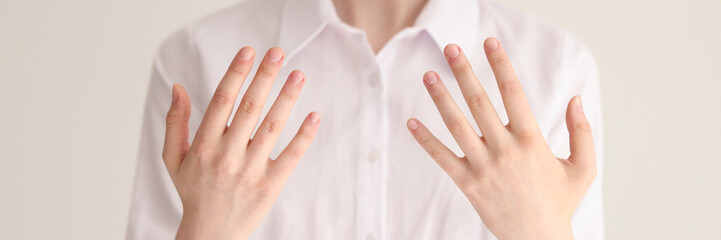 Young woman in white blouse shows hands to dermatologist