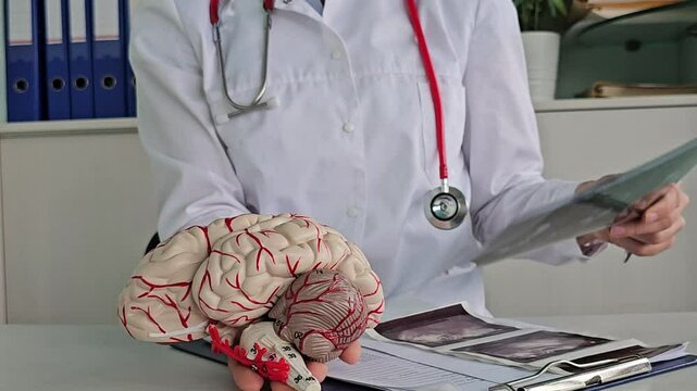 Doctor checks x-ray of brain using ST segment scanning. MRI of brain. Electroneuromyography