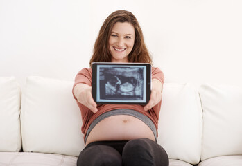 Home, woman and smile with pregnancy scan on sofa in living room for growth, future and maternity. Female person, fertility and smile on ultrasound for baby development, health or updates on portrait