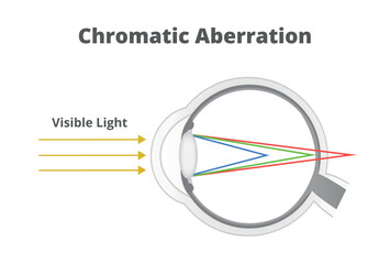 Vector illustration of chromatic aberration or refraction of light in the human eye. Shorter wavelength rays are focused in front of the retina, longer wavelength rays are focused behind the retina. 
