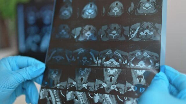 Doctor looking at a CT scan of the thyroid gland