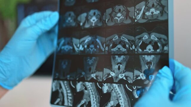 Computed tomography of the thyroid gland.