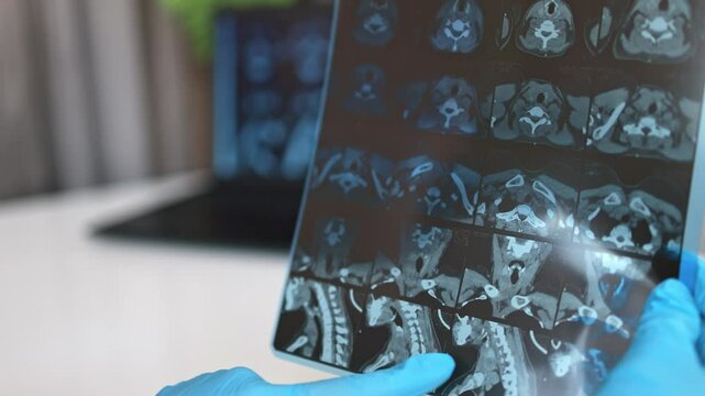 Doctor looking at a CT scan of the thyroid gland