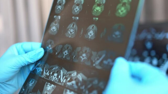 Computed tomography of the thyroid gland.