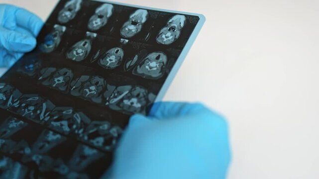 Computed tomography of the thyroid gland.