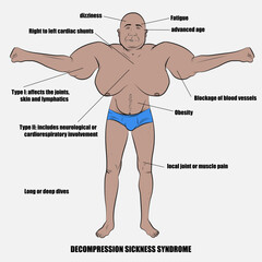 Vector decompression sickness syndrome.