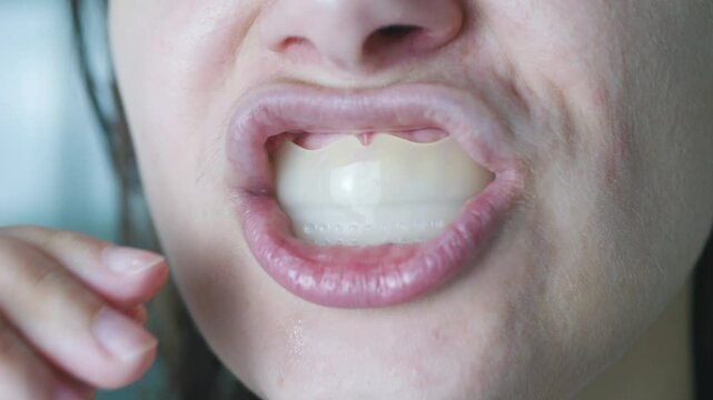 Woman putting a dental aligner orthodontic night guard on her teeth. Close up.