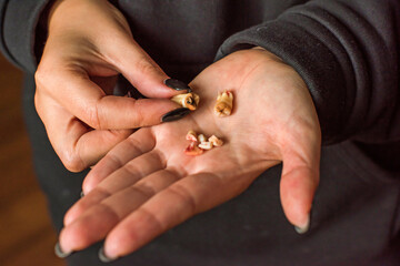 Wisdom teeth, 8th tooth with caries. Concept of dentistry and healthy teeth and oral cavity