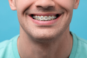 Smiling man with dental braces on light blue background, closeup