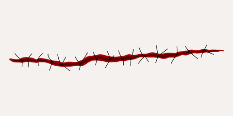 Red smear with splashes on white background, blood streaks, realistic element for Halloween. Sutured wound, scar, ruptures in body tissue, stitches.